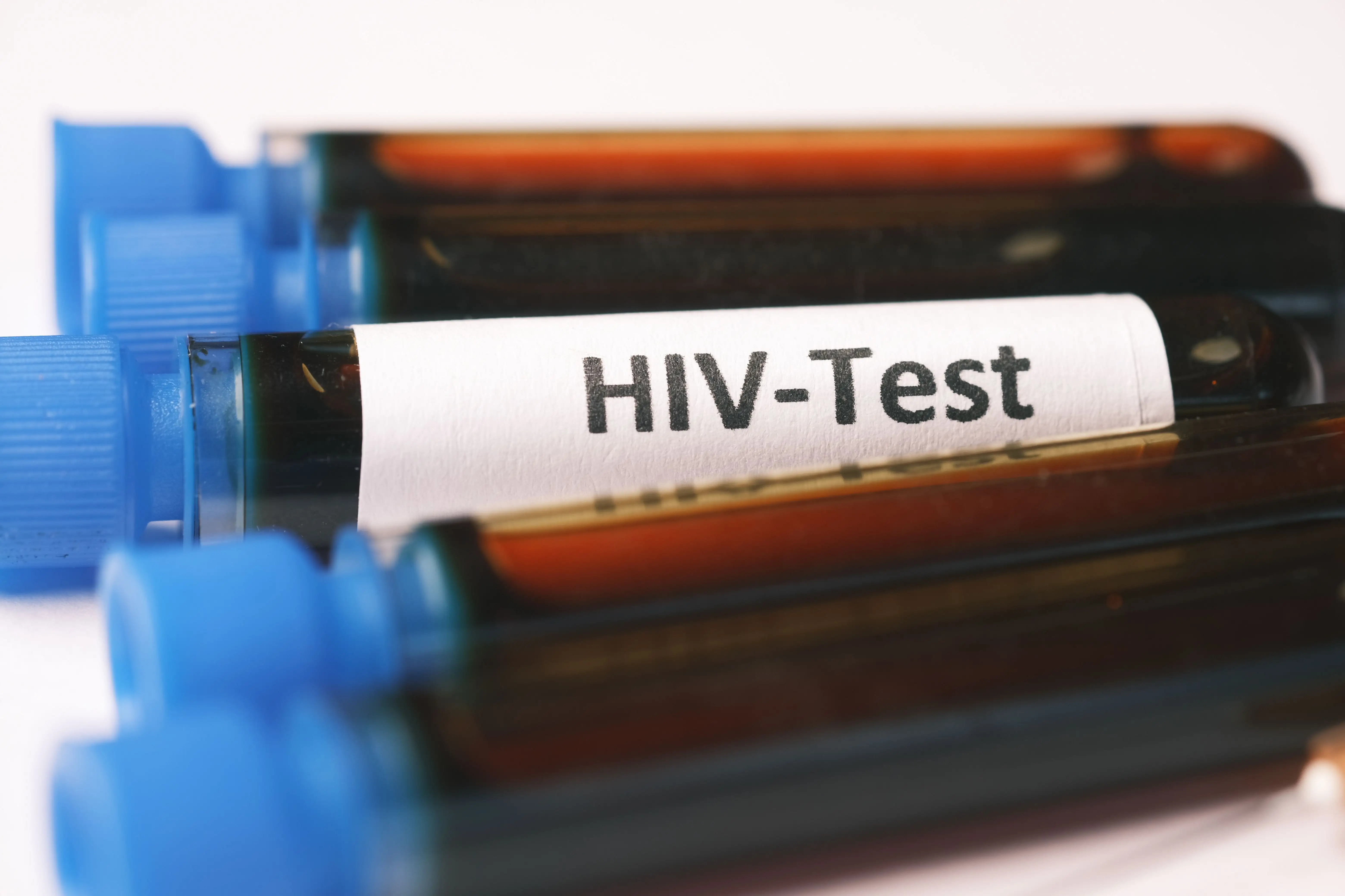 Kasus Baru Mulai Ditemukan di Usia Sekolah, Pemko Pekanbaru Perkuat Edukasi Pencegahan HIV/AIDS