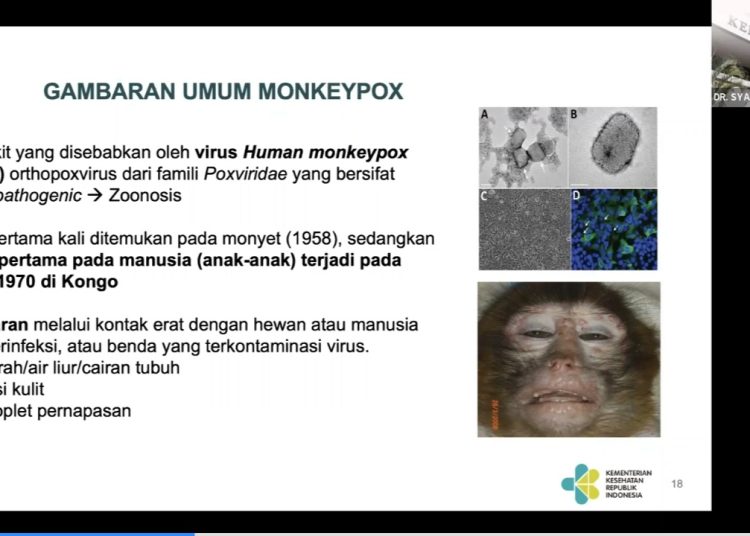 Tetap Waspada Walau Belum ada Laporan Kasus Cacar Monyet di Indonesia