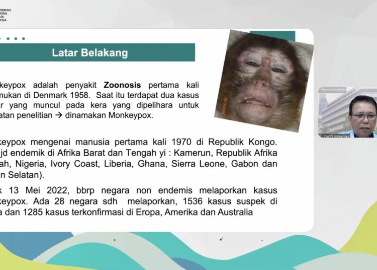 Karakteristik Monkeypox atau Cacar Monyet, Bisa Sembuh Sendiri
